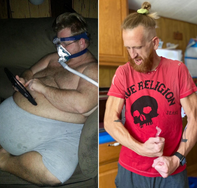Врачи сказали парню, что из-за ожирения ему осталось жить 3 года. Он похудел и выжил