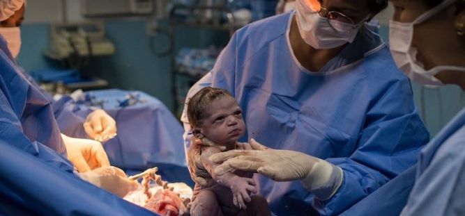 «Ты кто такой, дядя?»: фото угрюмого новорожденного стало вирусным в Сети