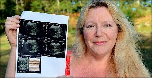 52-летняя «профессиональная» суррогатная мать собирается родить в 16-й раз