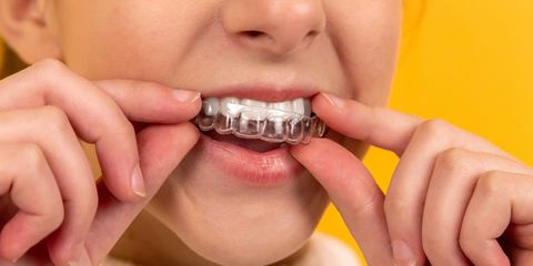 Какие проблемы с зубами могут быть врожденными?