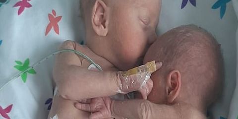 Фото близнецов, обнимающихся после разлуки, взорвало Интернет