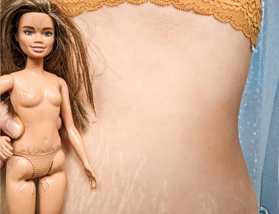 Чтобы дочь все знала: женщина нарисовала растяжки на теле Barbie