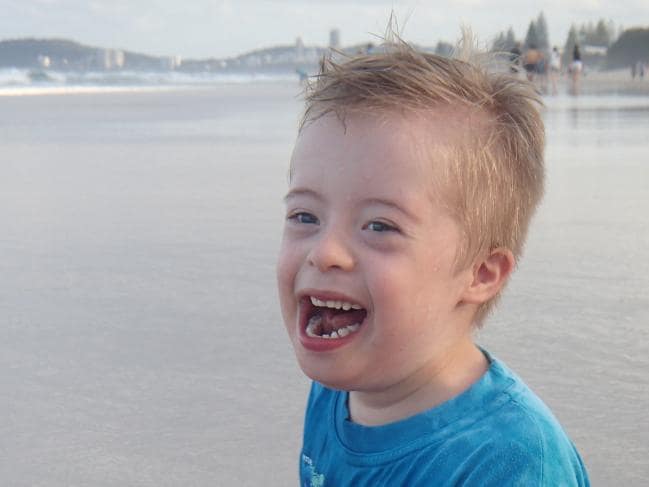 История 9-летнего австралийца с синдромом Дауна, который стал звездой "Ютьюба"