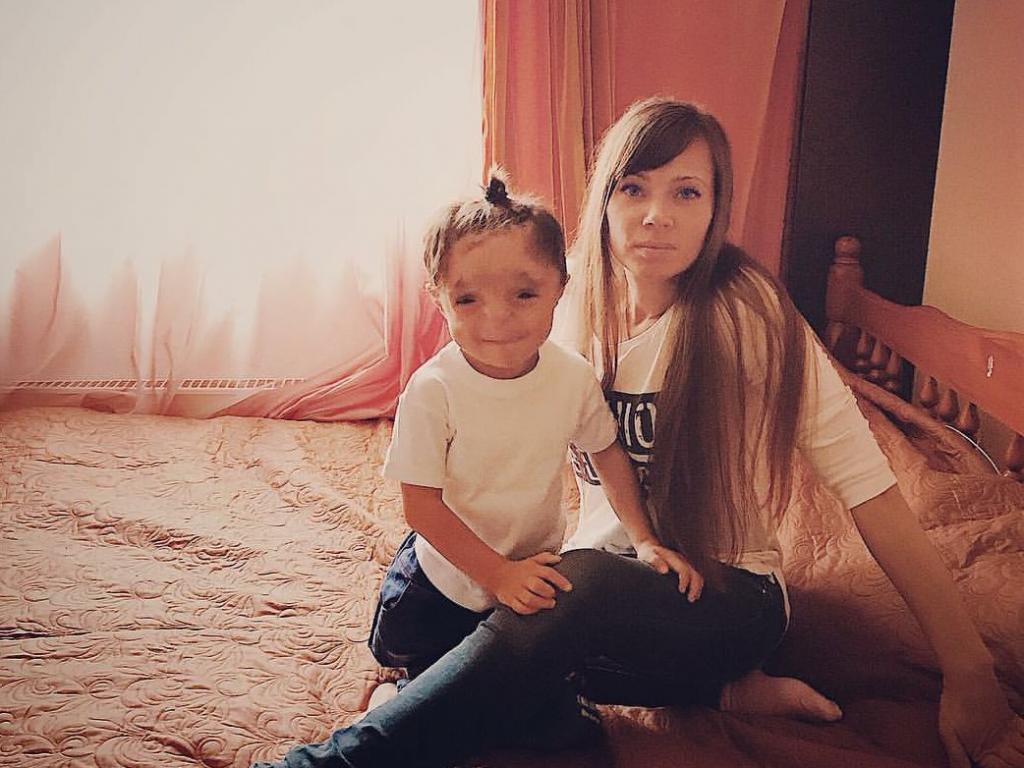 Москвичка усыновила малыша, которого никто не хотел, и сделала его звездой соцсетей