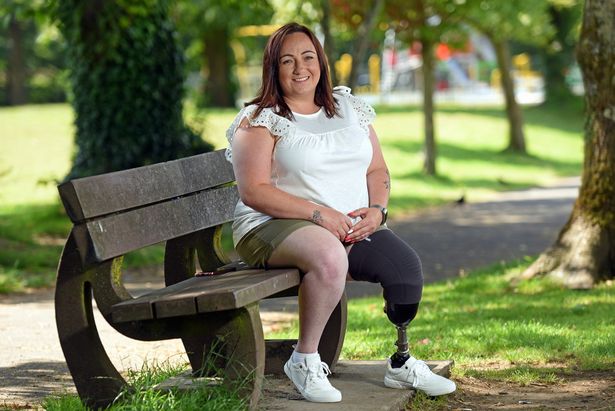 Женщина решилась на ампутацию ноги ради сохранения беременности