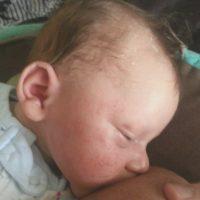 Сыпь у новорожденных детей: виды, причины, лечение