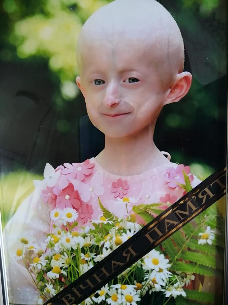 10-летняя девочка из Украины умерла от старости
