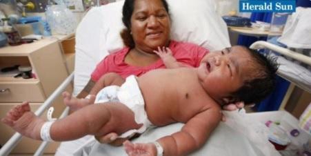 Женщина успешно родила 6-ти килограмового малыша