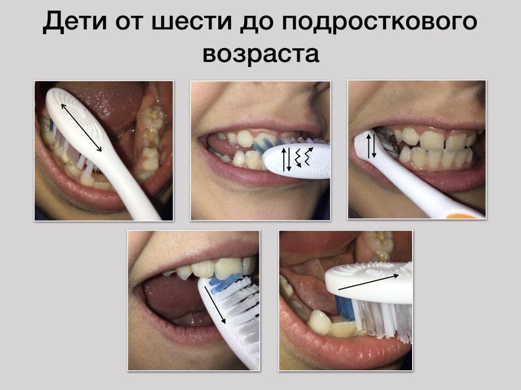 Чистим зубы правильно