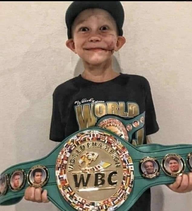 10-летнего мальчика признали чемпионом мира после того, как он спас сестру от собаки