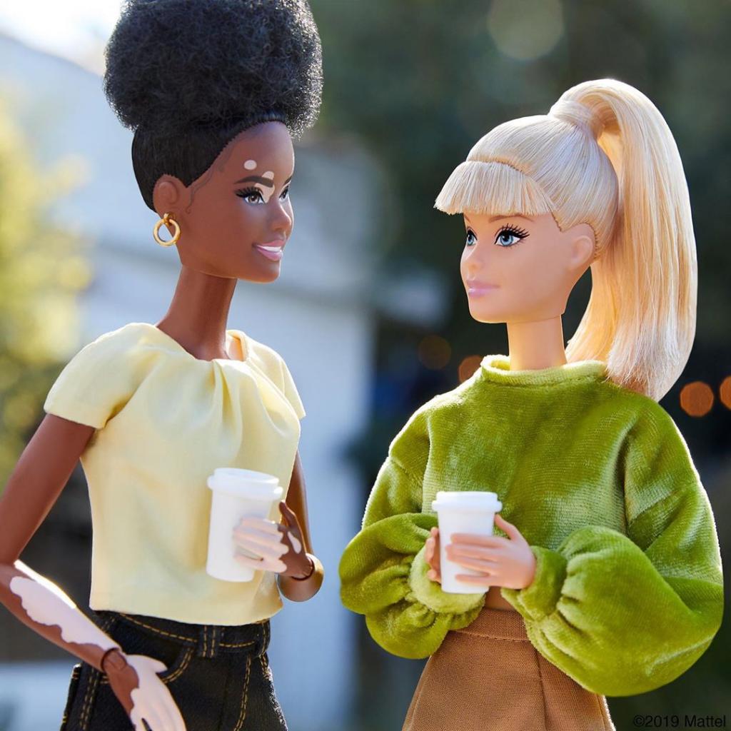 «Красота повсюду»: Mattel выпустил Барби с витилиго, лысиной и протезами