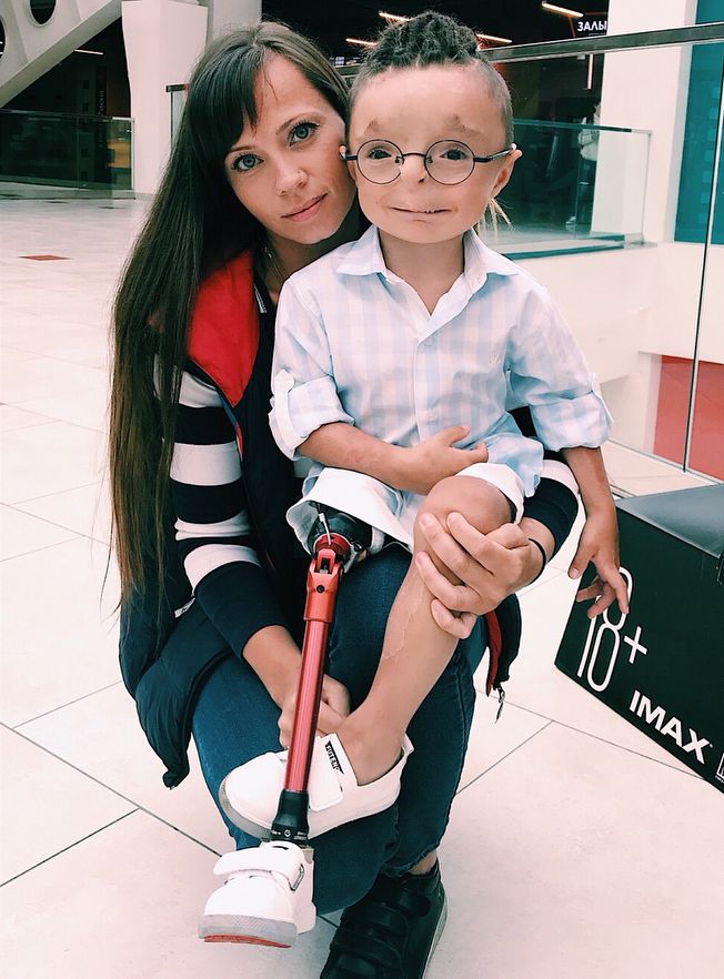 Москвичка усыновила малыша, которого никто не хотел, и сделала его звездой соцсетей
