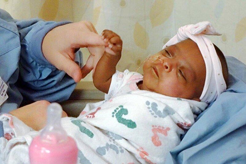 Самая маленькая новорожденная в мире была размером с яблоко