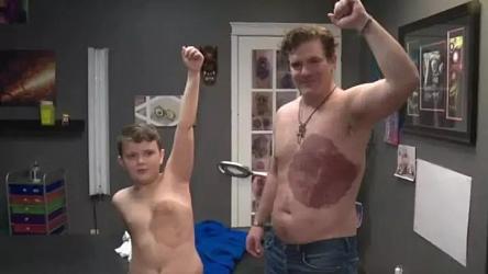 Мужчина сделал огромную татуировку в виде родимого пятна, чтобы поддержать сына  